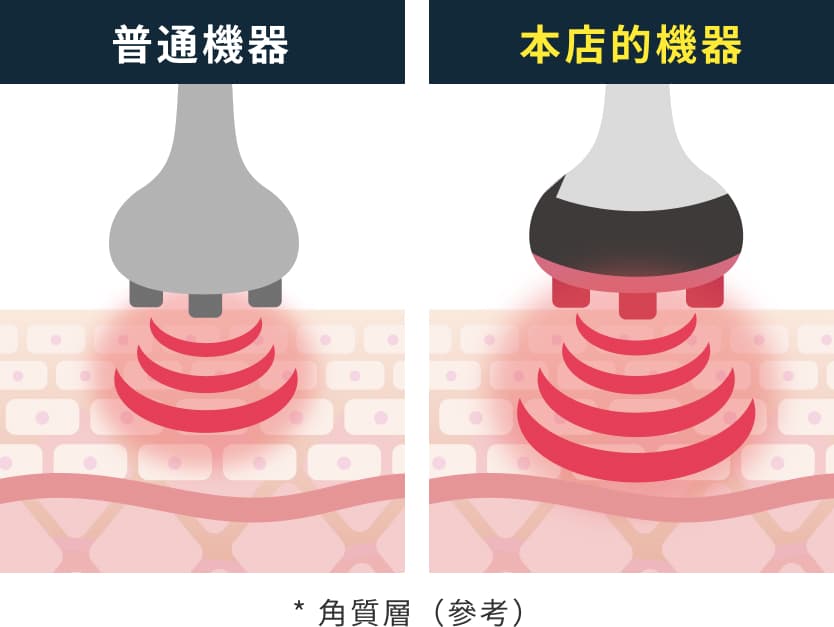 普通機器｜本店的機器 * 角質層（參考）